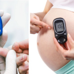 Diabete in gravidanza, 6 sintomi per riconoscerlo e cosa succede al bimbo in pancia
