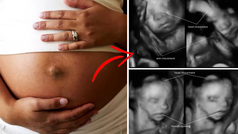 Cosa fa il feto quando la mamma accarezza il suo pancione? E’ incredibile, lo dice questo studio!