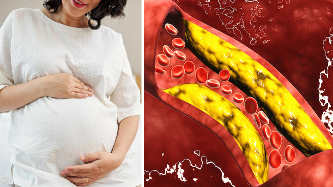 Colesterolo in gravidanza: quali sono i valori normali e come abbassarlo se i livelli sono alti!