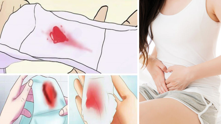Perdite da impianto o inizio delle mestruazioni? Ecco come riconoscere i sintomi!